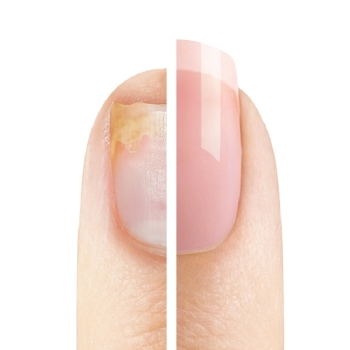 Croma Nail 8X1 - Vegano